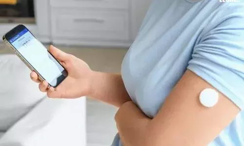 Unified-Patent-court